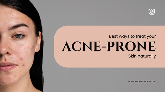 treat acne and prone skin naturally